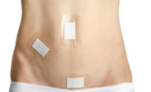 post operado de laparoscopia